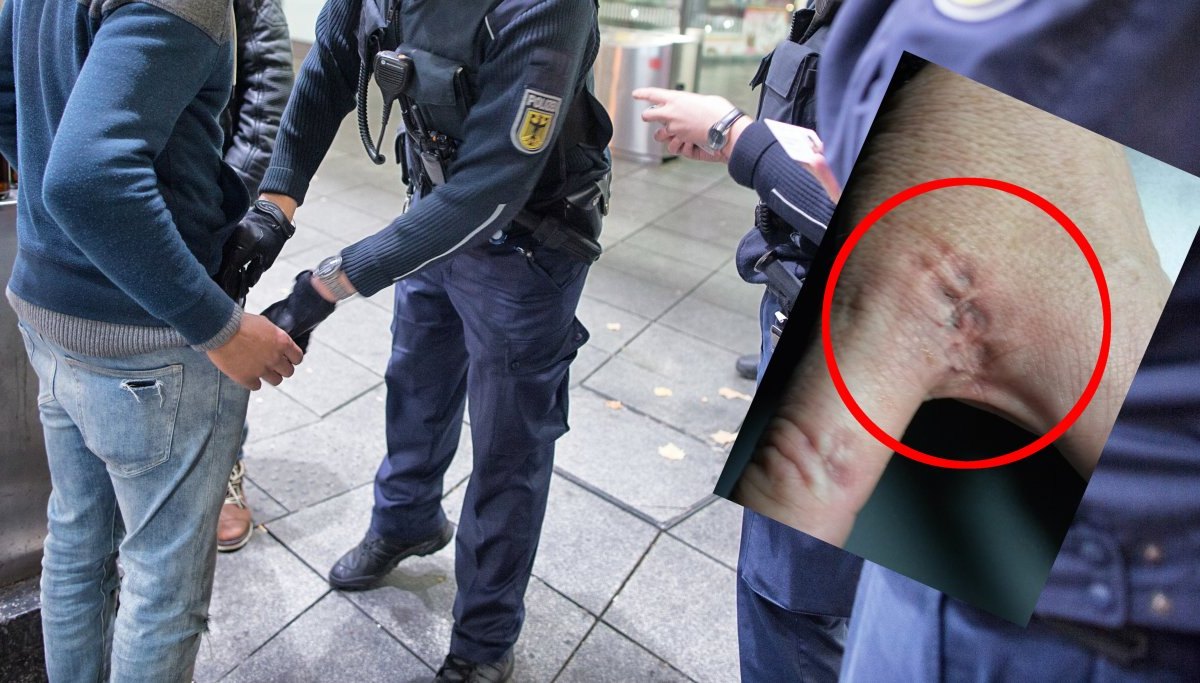 Bisswunde Hauptbahnhof Essen Bundespolizei.jpg