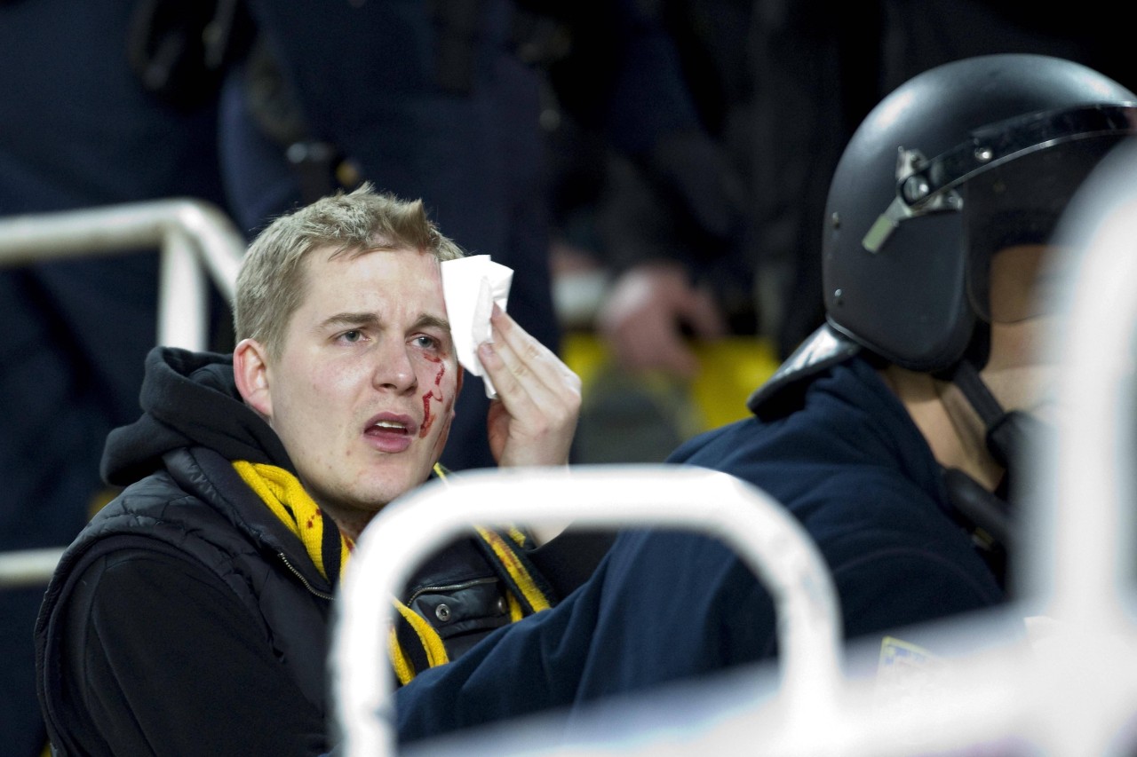 Ein verletzter BVB-Fan in Sevilla 2010.